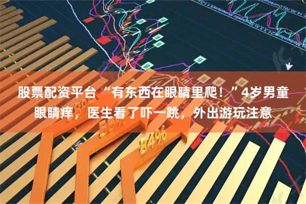 股票配资平台 “有东西在眼睛里爬！”4岁男童眼睛痒，医生看了吓一跳，外出游玩注意